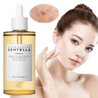 100ml Centella Asiatica Essence